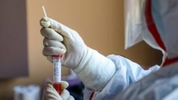 Devet osoba pod zdravstvenim nadzorom u Sarajevu zbog zabrinutosti od koronavirusa