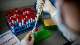 KORONAVIRUS U USK: 22 NOVOZARAŽENE OSOBE I DVA SMRTNA SLUČAJA