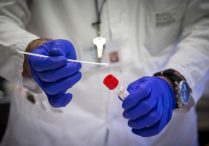 Od ponedjeljka u FBiH komercijalna cijena PCR testiranja 96 KM, a serološkog 36 KM