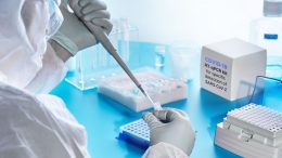 KORONA BILANS U USK: ČETIRI OSOBE PREMINULE, 30 NOVOZARAŽENIH