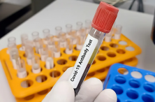 Šta trebate znati o provjeri antitijela nakon vakcinacije i koji test je najpouzdaniji