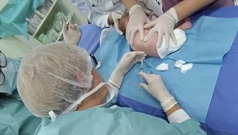 Tuzlanski ljekari prvi u BiH teško oboljeloj bebi aplicirali specijalnu injekciju protiv mišićne atrofije